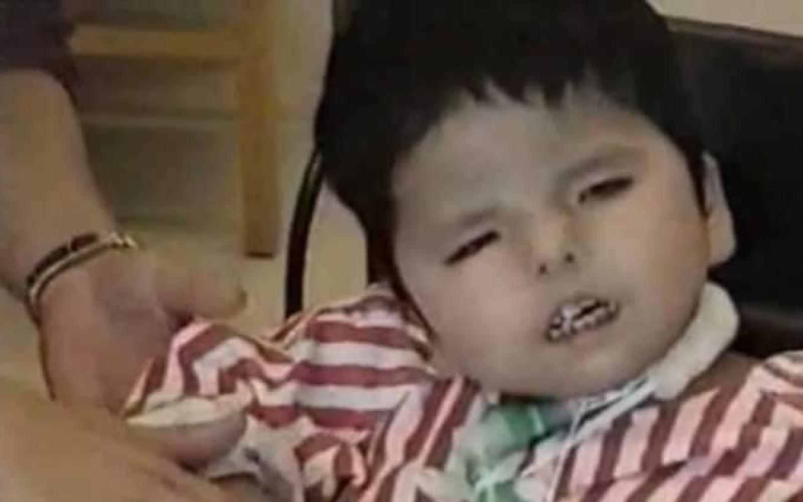 Young toddler with striped shirt on looking at the camera while an adult helps them